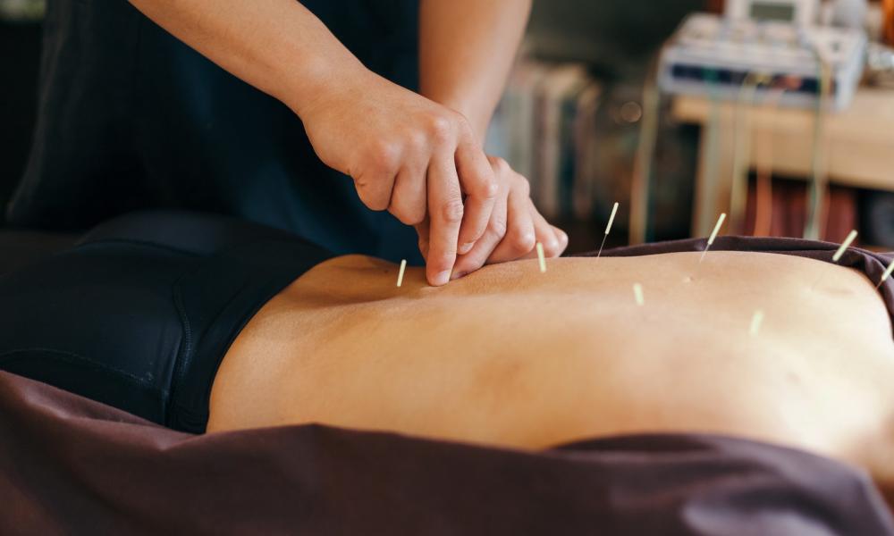 Acupuncture Therapy